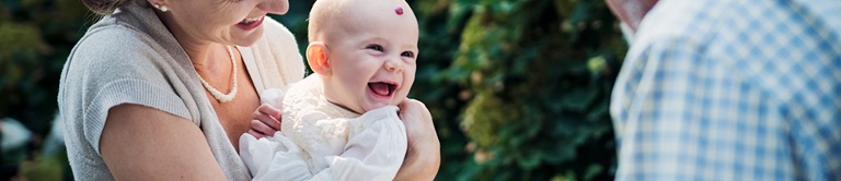 baby with a birthmark smiling