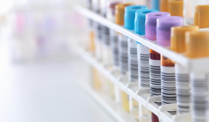 Lab samples