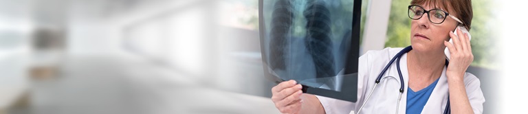 doctor looking at a lung scan